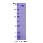 SDS-PAGE analysis of Human XDH Protein.