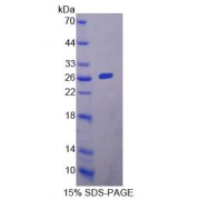 SDS-PAGE analysis of Mouse YAF2 Protein.