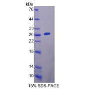 SDS-PAGE analysis of Mouse YAF2 Protein.