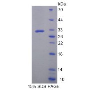 SDS-PAGE analysis of Human ZNF10 Protein.