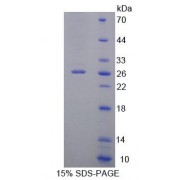SDS-PAGE analysis of Human ZRF1 Protein.
