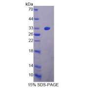 SDS-PAGE analysis of Mouse ZRF1 Protein.