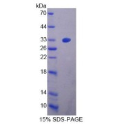 SDS-PAGE analysis of Mouse ZRF1 Protein.