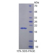SDS-PAGE analysis of Mouse MARCO Protein.