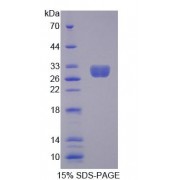 SDS-PAGE analysis of recombinant Human MECP2 Protein.