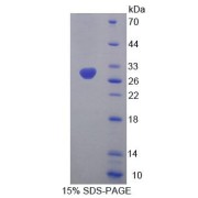 SDS-PAGE analysis of Human MFN1 Protein.