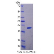 SDS-PAGE analysis of Human MRPL1 Protein.