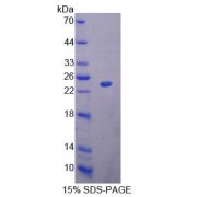 SDS-PAGE analysis of Rat MRPL1 Protein.