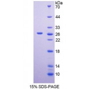 SDS-PAGE analysis of recombinant Human MSRA Protein.