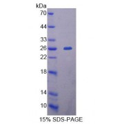SDS-PAGE analysis of Human MTERF Protein.