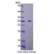 SDS-PAGE analysis of Human MTERF Protein.