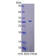 SDS-PAGE analysis of recombinant Human MTF1 Protein.