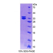 SDS-PAGE analysis of Human MTUS1 Protein.