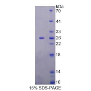 SDS-PAGE analysis of Rat MTUS1 Protein.