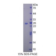 SDS-PAGE analysis of Rat MTX1 Protein.