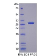 SDS-PAGE analysis of Human MYT1 Protein.