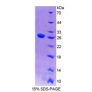 SDS-PAGE analysis of Mouse MYT1 Protein.