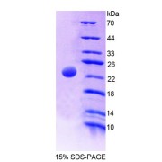 SDS-PAGE analysis of Rat MATK Protein.