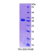 SDS-PAGE analysis of Human DMPK Protein.
