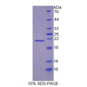 SDS-PAGE analysis of Rat DMPK Protein.