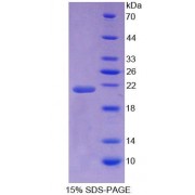 SDS-PAGE analysis of Human NSF Protein.
