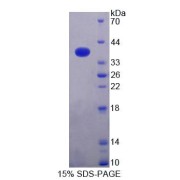 SDS-PAGE analysis of Human NAPa Protein.