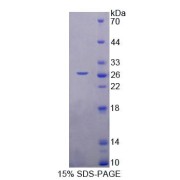 SDS-PAGE analysis of Rat NASP Protein.