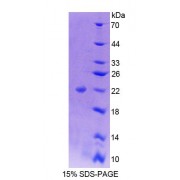 SDS-PAGE analysis of Human NFIA Protein.