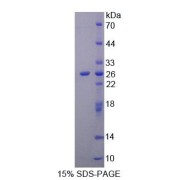 SDS-PAGE analysis of Rat NIN Protein.