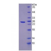 SDS-PAGE analysis of Human NOVA1 Protein.