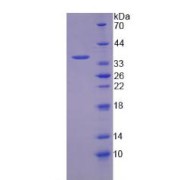 SDS-PAGE analysis of Human NP Protein.