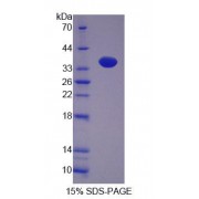 SDS-PAGE analysis of Rat NP Protein.