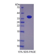 SDS-PAGE analysis of Rat NP Protein.