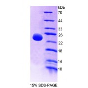 SDS-PAGE analysis of recombinant Human OLFM3 Protein.