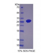 SDS-PAGE analysis of Rat OPHN1 Protein.