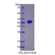 SDS-PAGE analysis of Rat OPHN1 Protein.