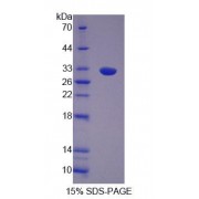 SDS-PAGE analysis of Human OS9 Protein.