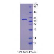 SDS-PAGE analysis of Rat OS9 Protein.