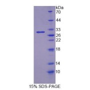 SDS-PAGE analysis of Rat OS9 Protein.