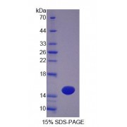 SDS-PAGE analysis of Mouse OTOR Protein.
