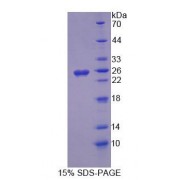 SDS-PAGE analysis of Rat OPA3 Protein.
