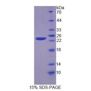 SDS-PAGE analysis of Human ANO2 Protein.