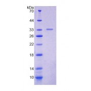 SDS-PAGE analysis of Mouse POLa1 Protein.