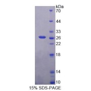 SDS-PAGE analysis of Human PCM1 Protein.