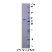 SDS-PAGE analysis of Rat PCM1 Protein.