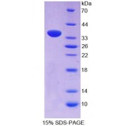 SDS-PAGE analysis of Human PCNT Protein.