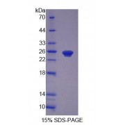SDS-PAGE analysis of Human PEX1 Protein.