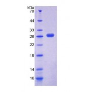 SDS-PAGE analysis of Mouse PEX1 Protein.