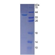 SDS-PAGE analysis of Human PITPNb Protein.