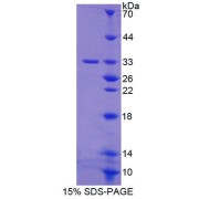 SDS-PAGE analysis of Human PKD3 Protein.